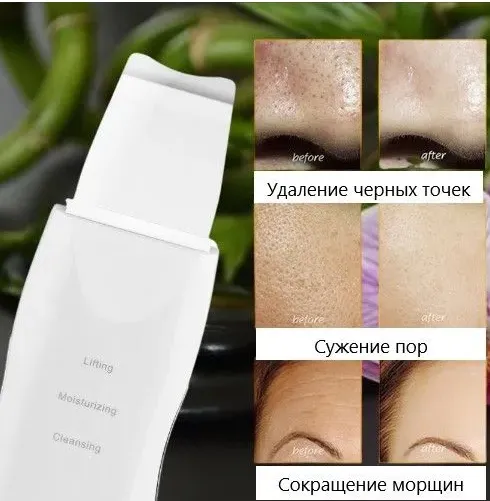 Прибор для ультрафиолетовой чистки лица Sonic Skin Scrubber